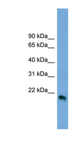 IFNB1 / Interferon Beta antibody LS-C116292 Western blot of HeLa lysate.