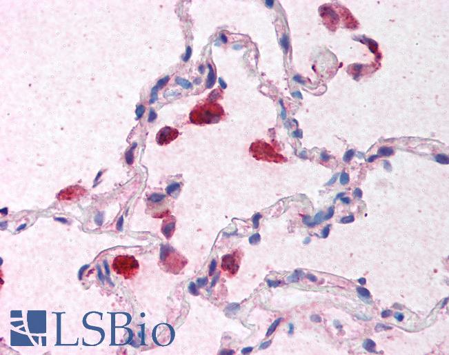 Anti-Interferon Beta antibody IHC of human lung. Immunohistochemistry of formalin-fixed, paraffin-embedded tissue after heat-induced antigen retrieval. Antibody LS-B1361 concentration 5 ug/ml.