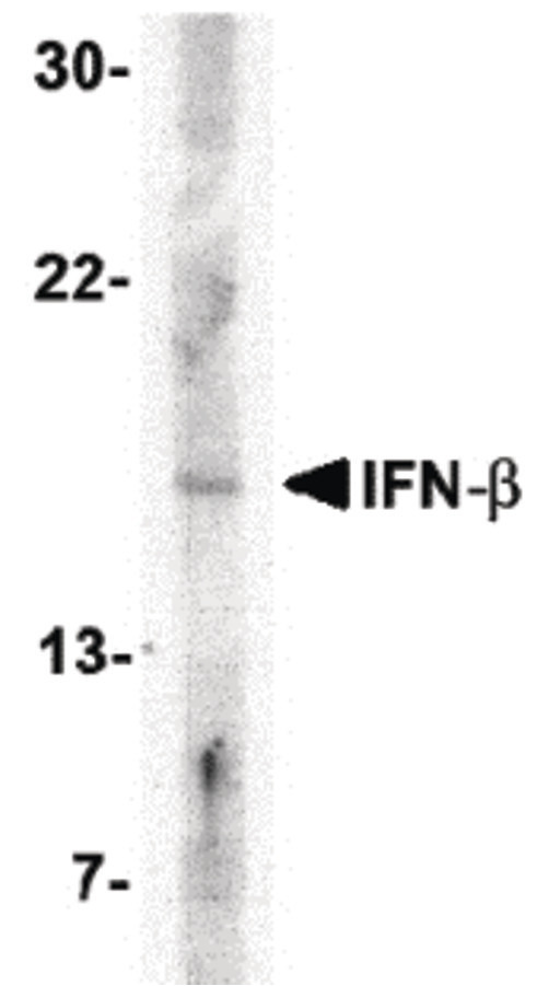 Western blot of IFN-b in A-20 cell lysate with IFN-b antibody at 5 ug/ml.