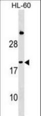 IFNA1 Antibody western blot of HL-60 cell line lysates (35 ug/lane). The IFNA1 antibody detected the IFNA1 protein (arrow).
