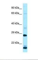 Western blot of Human ACHN whole cell. IFNA16 antibody dilution 1.0 ug/ml.