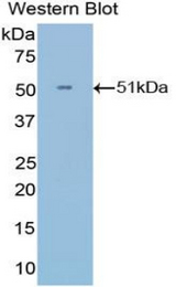 Western blot of recombinant IFNA21.