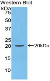 Western blot of recombinant IFNA4 / Interferon Alpha 4.