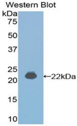 Western blot of recombinant IFNA4 / Interferon Alpha 4.