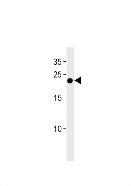 IFNA4 Antibody western blot of U937 cell line lysates (35 ug/lane). The IFNA4 antibody detected the IFNA4 protein (arrow).