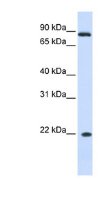 IFNA7 antibody LS-C102622 Western blot of Fetal liver lysate.