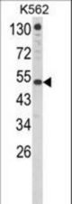 Western blot of IFNAR1 Antibody in K562 cell line lysates (35 ug/lane). IFNAR1 (arrow) was detected using the purified antibody.(8 ug/ml)