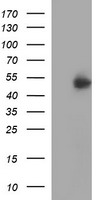 HEK293T cells were transfected with the pCMV6-ENTRY control (Left lane) or pCMV6-ENTRY IFNGR2 (Right lane) cDNA for 48 hrs and lysed. Equivalent amounts of cell lysates (5 ug per lane) were separated by SDS-PAGE and immunoblotted with anti-IFNGR2.