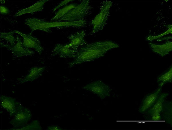 Immunofluorescence of monoclonal antibody to IFNGR2 on HeLa cell . [antibody concentration 10 ug/ml]