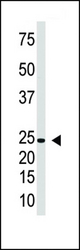 The anti-IL29 antibody is used in Western blot to detect IL29 in Jurkat cell lysate.