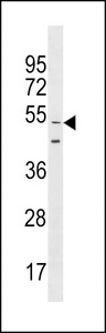 GOLGA6L9 Antibody western blot of CEM cell line lysates (35 ug/lane). The GOLGA6L9 antibody detected the GOLGA6L9 protein (arrow).