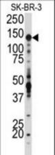 Western blot of anti-IGF1R Antibody in SK-BR-3 cell line lysates (35 ug/lane). IGF1R (arrow) was detected using the purified antibody.