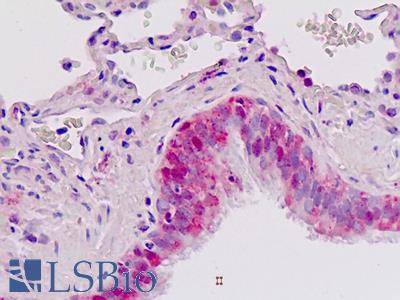 Anti-IGFBP2 / IGF-BP53 antibody IHC staining of human lung, respiratory epithelium. Immunohistochemistry of formalin-fixed, paraffin-embedded tissue after heat-induced antigen retrieval.