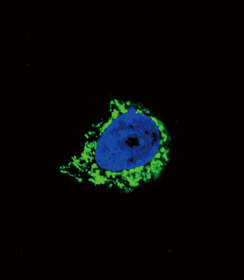 Confocal immunofluorescent of IGFBP2 Antibody with A549 cell followed by Alexa Fluor 488-conjugated goat anti-rabbit lgG (green). DAPI was used to stain the cell nuclear (blue).