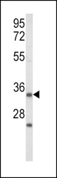 Western blot of IGFBP2 Antibody in Jurkat cell line lysates (35 ug/lane). IGFBP2 (arrow) was detected using the purified antibody.(2 ug/ml)