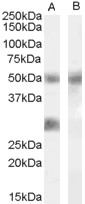 Antibody (0.02 ug/ml) staining of Human Breast cancer lysate (35 ug protein in RIPA buffer) with (B) and without (A) blocking with the immunizing peptide. Primary incubation was 1 hour. Detected by chemiluminescence.