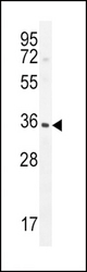 IGFBP3-S183 western blot of CHO tissue lysates (15 ug/lane). The IGFBP antibody detected IGFBP protein (arrow).