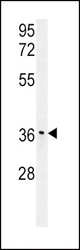 IGFBP3-S183 western blot of mouse stomach tissue lysates (15 ug/lane). The IGFBP antibody detected IGFBP protein (arrow).