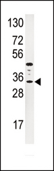 Western blot of anti-IGFBP3 Antibody in HepG2 cell line lysates (35 ug/lane). IGFBP3(arrow) was detected using the purified antibody.