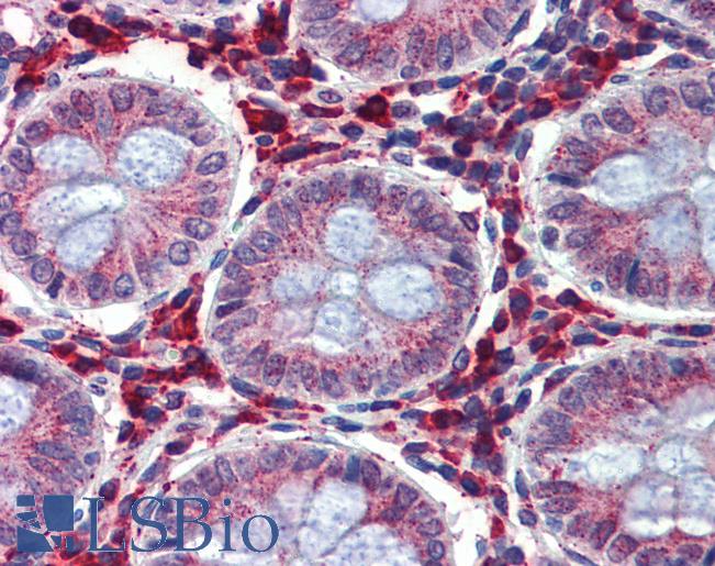 Anti-IGFBP4 antibody IHC of human colon. Immunohistochemistry of formalin-fixed, paraffin-embedded tissue after heat-induced antigen retrieval. Antibody LS-B3992 concentration 5 ug/ml.