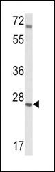 Western blot of IGFBP4 Antibody in mouse lung tissue lysates (35 ug/lane). IGFBP4 (arrow) was detected using the purified antibody.
