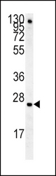 IGFBP4 Antibody western blot of mouse lung tissue lysates (15 ug/lane). The IGFBP4 antibody detected IGFBP4 protein (arrow).