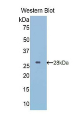 Western blot of recombinant IGFBP5 / IGFBP-5.