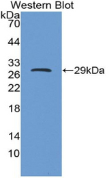 Western blot of recombinant IGFBP5.