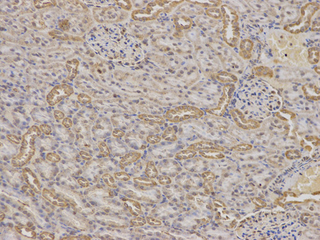 Immunohistochemistry of paraffin-embedded rat kidney using IGFBP5 antibody at dilution of 1:100 (200x lens).