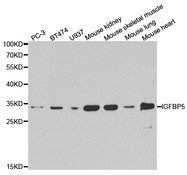 Western blot analysis of extracts of various cell lines, using IGFBP5 antibody.
