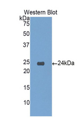 Western blot of recombinant IGFBP6 / IGFBP-6.