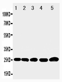 WB of IGFBP6 / IGFBP-6 antibody. All lanes: Anti-IGFBP6 at 0.5ug/ml. Lane 1: Rat Liver Tissue Lysate at 40ug. Lane 2: Rat Pancreas Tissue Lysate at 40ug. Lane 3: Rat Brain Tissue Lysate at 40ug. Lane 4: Rat Kidney Tissue Lysate at 40ug. Lane 5: SMMC Whole Cell Lysate at 40ug. Predicted bind size: 25KD. Observed bind size: 25KD.