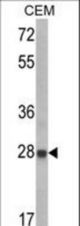 Western blot of IGFBP6 Antibody in CEM cell line lysates (35 ug/lane). IGFBP6 (arrow) was detected using the purified antibody.