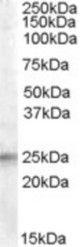Antibody (0.5 ug/ml) staining of Human Adrenal Gland lysate (35 ug protein in RIPA buffer). Primary incubation was 1 hour. Detected by chemiluminescence.