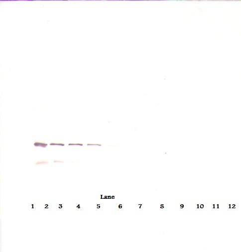 Western Blot (reducing) of IGFBP7 / TAF antibody LS-B8205