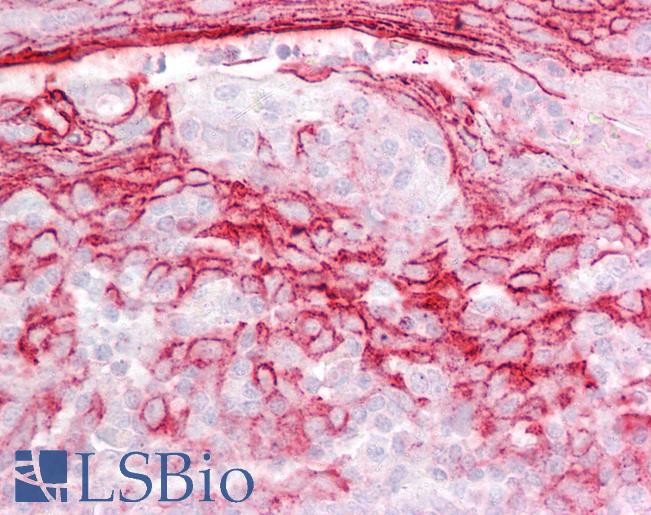 Anti-IGFBP7 antibody IHC of human tonsil. Immunohistochemistry of formalin-fixed, paraffin-embedded tissue after heat-induced antigen retrieval. Antibody LS-B6473 concentration 2.5 ug/ml.