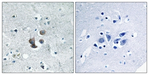 IHC of paraffin-embedded human brain tissue, using IBP7 Antibody. The sample on the right was incubated with synthetic peptide.