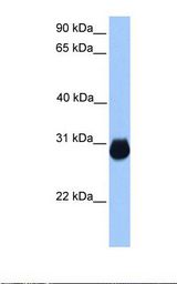 Fetal muscle lysate. Antibody concentration: 1.0 ug/ml. Gel concentration: 12%.