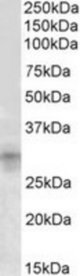 IGFBP7 antibody (1 ug/ml) staining of Mouse Kidney lysate (35 ug protein/ml in RIPA buffer). Primary incubation was 1 hour. Detected by chemiluminescence.