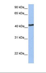 Fetal brain lysate. Antibody concentration: 1.0 ug/ml. Gel concentration: 12%.
