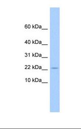 721_B cell lysate. Antibody concentration: 1.0 ug/ml. Gel concentration: 10-20%.