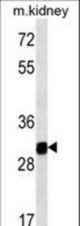 GNPDA1 western blot of mouse kidney tissue lysates (35 ug/lane). The GNPDA1 antibody detected the GNPDA1 protein (arrow).