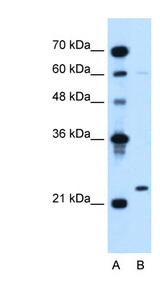 IGLL1 antibody LS-C40391 Western blot of Jurkat lysate.