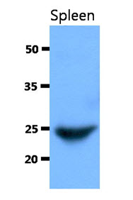 Western Blot: The extract of Mouse Spleen (40 ug) were resolved by SDS-PAGE, transferred to PVDF membrane and probed with anti-human IGLL1 antibody (1:1000). Proteins were visualized using a goat anti-mouse secondary antibody conjugated to HRP and an ECL detection system.