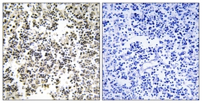 IHC of paraffin-embedded human lymph node, using IGLL1 Antibody. The picture on the right is treated with the synthesized peptide.