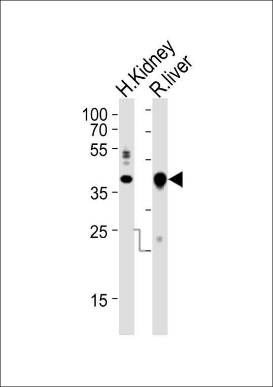 Western blot of lysates from human Kidney, rat liver tissue lysate (from left to right) with Ihh Antibody. Antibody was diluted at 1:1000 at each lane. A goat anti-rabbit IgG H&L (HRP) at 1:10000 dilution was used as the secondary antibody. Lysates at 20 ug per lane.