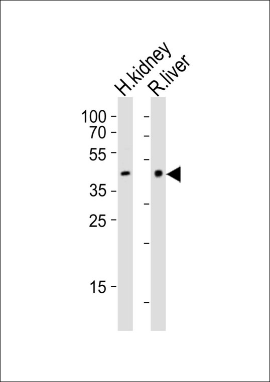 Western blot of lysates from human kidney and rat liver tissue (from left to right) with Ihh Antibody. Antibody was diluted at 1:1000 at each lane. A goat anti-rabbit IgG H&L (HRP) at 1:10000 dilution was used as the secondary antibody. Lysates at 20 ug per lane.