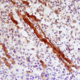 Indian Hedgehog in Mouse Embryo. Indian Hedgehog was detected in immersion fixed frozen sections of mouse embryo (15 d. p. c.) using Goat Anti-Mouse Indian Hedgehog N-Terminus Antigen Affinity-purified Polyclonal Antibody at 15 ug/ml overnight at 4°C. Tissue was stained using Anti-Goat HRP-DAB (brown) and counterstained with hematoxylin (blue). Specific staining was localized to muscle cells.