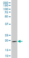 IHH monoclonal antibody (M01), clone 2G9 Western Blot analysis of IHH expression in Jurkat.