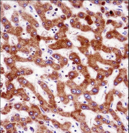 IHH Antibody immunohistochemistry of formalin-fixed and paraffin-embedded human liver tissue followed by peroxidase-conjugated secondary antibody and DAB staining.